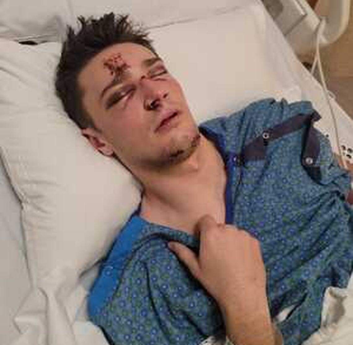Landon Cochran was seriously injured following a hit and run incident on New Years Day. Police are asking for help in locating the vehicle.