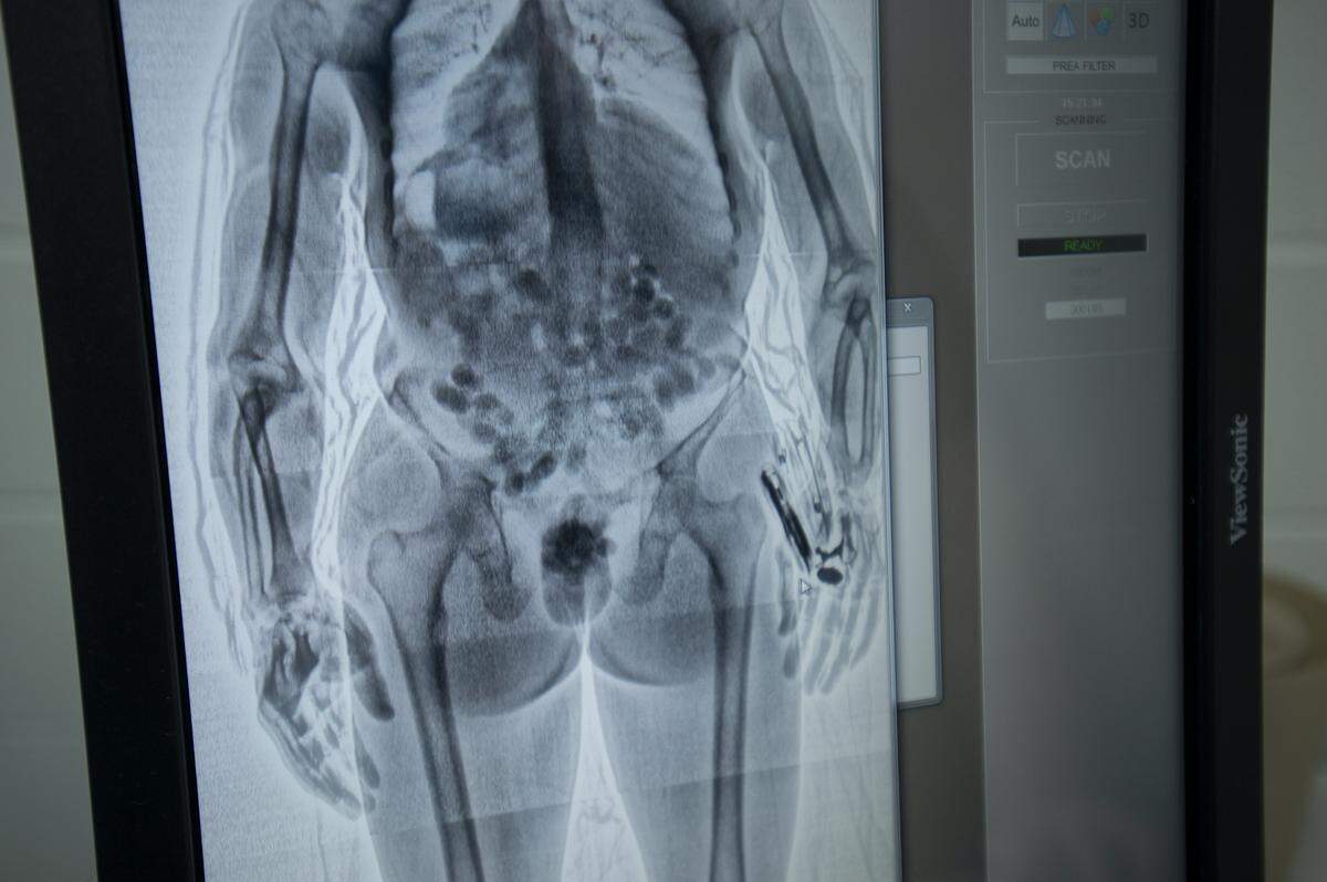 Packets of drugs can be seen inside the colon on a training image that helps operators identify anomalies in body scanner images at the Whatcom County Jail.
