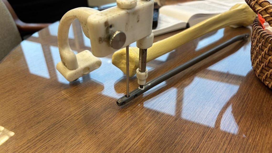 WWU team patents device to help surgeons repair large broken bones