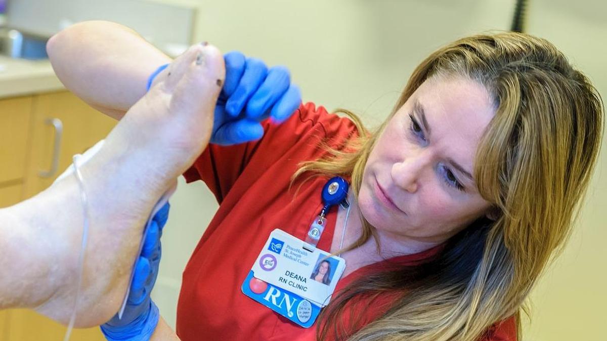 Registered nurse Dana Latham applies a PICO on the foot of patient David Lyseng at the PeaceHealth Wound Healing Center Dec. 13 in Bellingham. Lyseng suffers from veinous hypertension (vericose veins) and diabetes. Latham says that the PICO, a negative pressure wound therapy device, draws out excess fluid from a wound and protects the injured area from getting dirty which helps promote healing