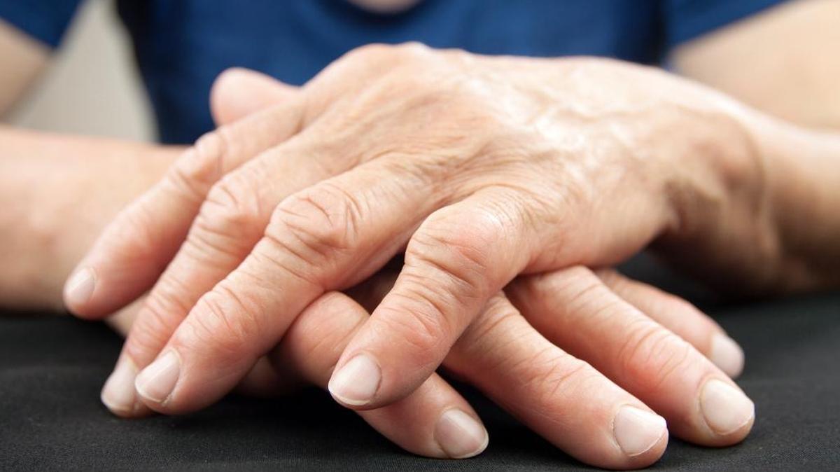 About 1.5 million people in the United States have rheumatoid arthritis (RA), according to the Arthritis Foundation. Glenna Allbritton of Mount Baker Rheumatolgy talks about the disease and treating it.