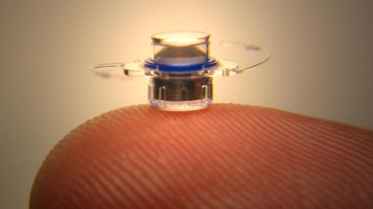 Surgeons are implanting the Implantable Miniature Telescope to help patients with age-related macular degeneration.
