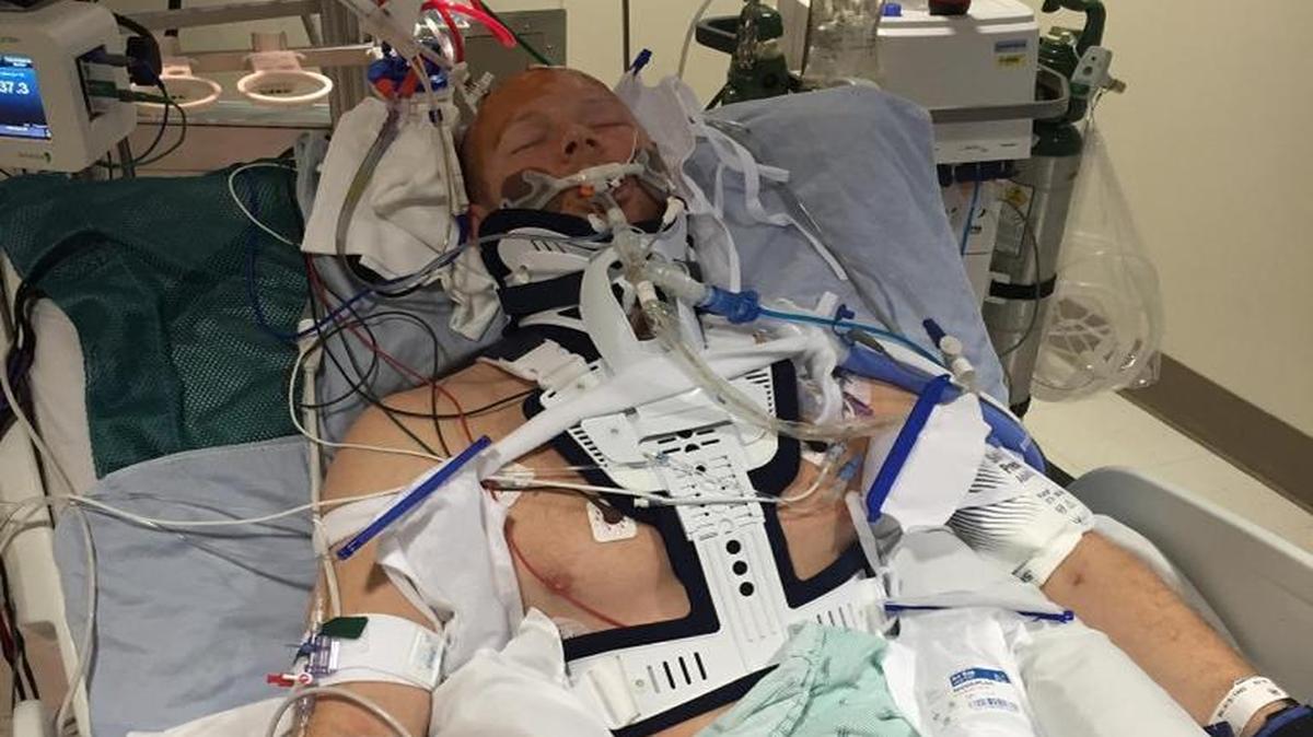 Shea Baumgart, 30, of Bellingham, in a hospital bed. He suffered severe injuries to his head, lungs and spine when his car hit a deer near Westport.