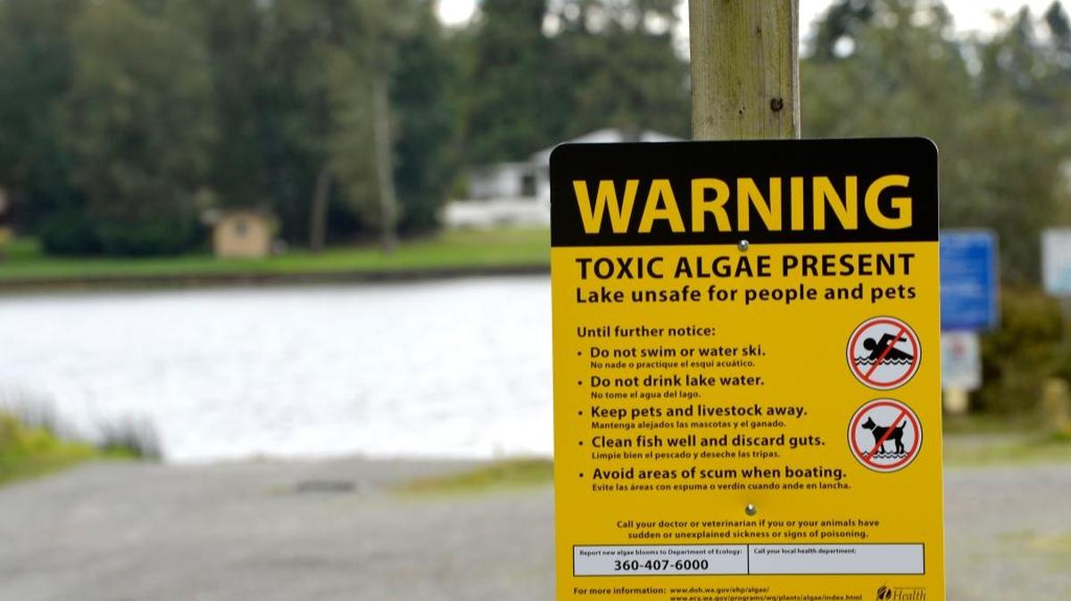 A sign at Wiser Lake, south of Lynden, Sept. 8, 2015, warns about toxic algae in the lake.