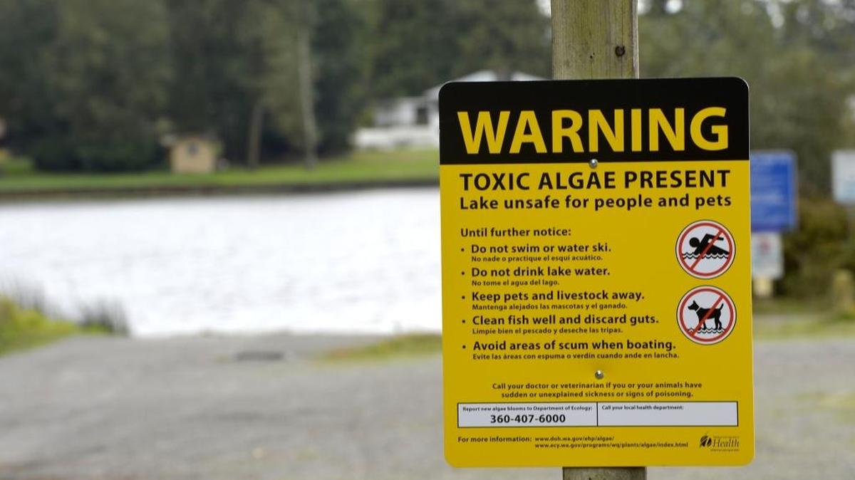 A sign at Wiser Lake, south of Lynden in Whatcom County, Wash, warns about toxic algae in the lake. Toxin levels at the lake are more than 20 times the maximum considered safe by the U.S. Environmental Protection Agency, according to a news release Friday, June 11,