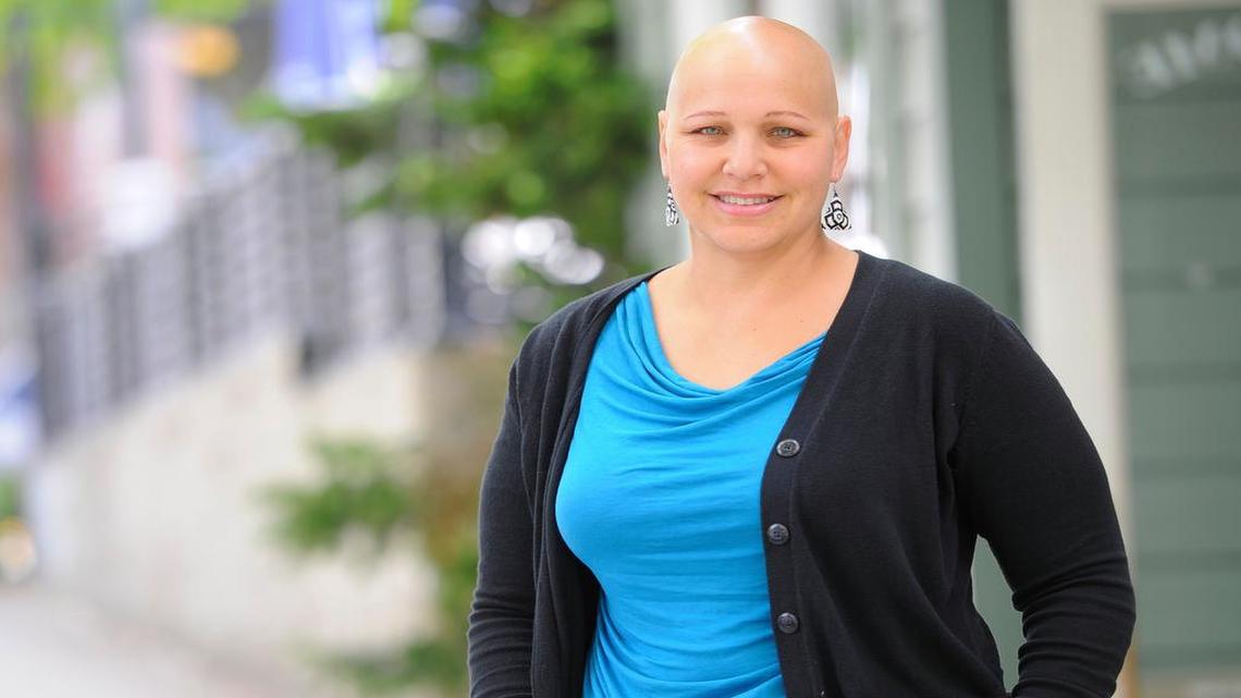 Living with alopecia: Skagit woman faces baldness head-on with new book