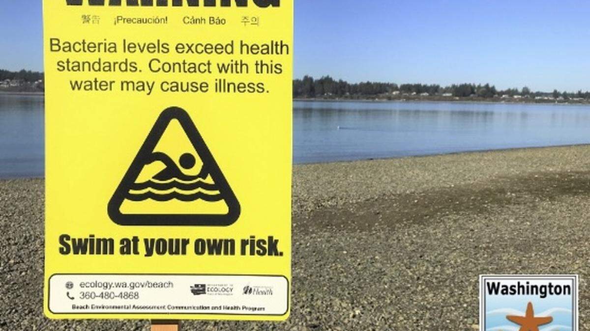 Whatcom County Health and Community Services issued an advisory at Boulevard Park on May 31, 2024, in Bellingham, Wash. The Department notified the public to ‘Swim at your own risk,’ as measured bacteria levels in the water near Taylor Dock exceeded health standards and could cause illness.