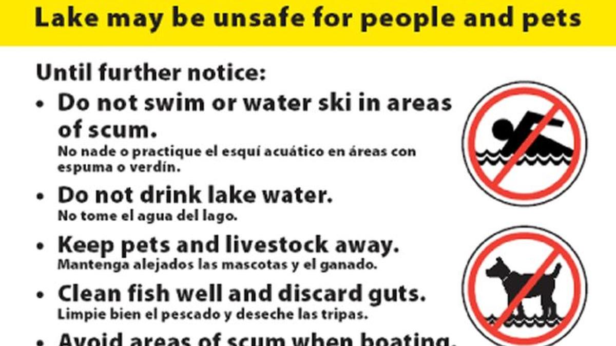 Signs posted around Lake Padden are warning park-goers about possible toxic algae.