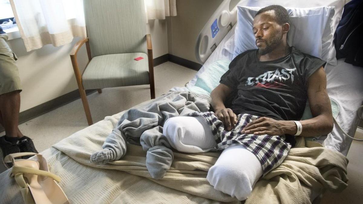 Cortney Spencer, 29, rests in his room at St. Joseph Medical Center on Wednesday. Spencer was hit by an allegedly drunken driver earlier this month and lost his legs.